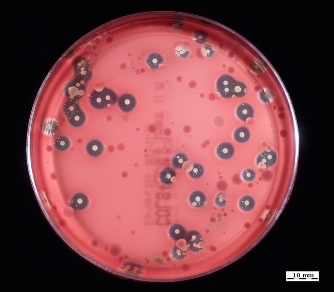 beta hemolysis
